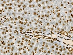 Invitrogen Phospho-JAK2 (Tyr1008) Polyclonal Antibody 100 &mu;L; Unconjugated:Antibodies,