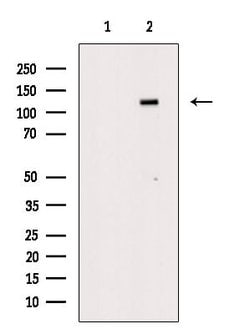 Invitrogen Phospho-JAK2 (Tyr1008) Polyclonal Antibody 100 &mu;L; Unconjugated:Antibodies,