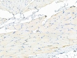 Invitrogen Phospho-LRRK2 (Ser935) Polyclonal Antibody 100 &mu;L; Unconjugated:Antibodies,