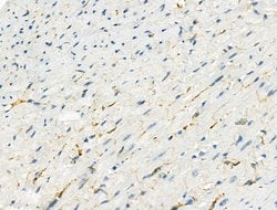 Invitrogen Phospho-LRRK2 (Ser935) Polyclonal Antibody 100 &mu;L; Unconjugated:Antibodies,