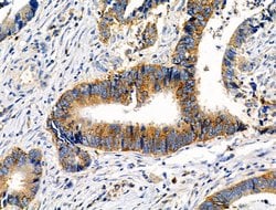 Phospho-MEK7 (Thr275) Polyclonal Antibody:Antibodies, Polyclonal