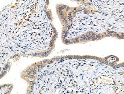 Phospho-MEK7 (Thr275) Polyclonal Antibody:Antibodies, Polyclonal