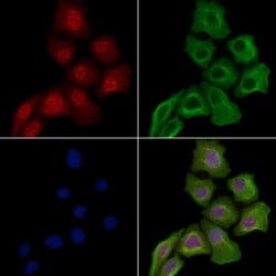 Invitrogen Phospho-NPM1 (Ser125) Polyclonal Antibody 100 &mu;L | Buy Online | Invitrogen&trade; | Fisher Scientific