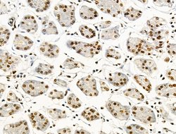 Invitrogen Phospho-NPM1 (Ser125) Polyclonal Antibody 100 &mu;L | Buy Online | Invitrogen&trade; | Fisher Scientific