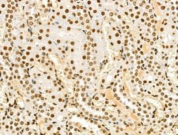 Invitrogen Phospho-NPM1 (Ser125) Polyclonal Antibody 100 &mu;L | Buy Online | Invitrogen&trade; | Fisher Scientific