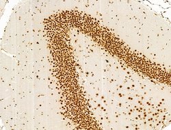 Invitrogen Phospho-NPM1 (Ser125) Polyclonal Antibody 100 &mu;L | Buy Online | Invitrogen&trade; | Fisher Scientific