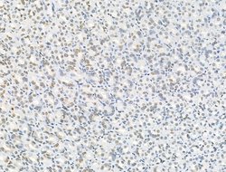 Invitrogen Phospho-NPM1 (Ser125) Polyclonal Antibody 100 &mu;L | Buy Online | Invitrogen&trade; | Fisher Scientific