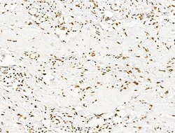 Invitrogen Phospho-NPM1 (Ser125) Polyclonal Antibody 100 &mu;L | Buy Online | Invitrogen&trade; | Fisher Scientific
