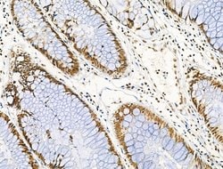 Invitrogen Phospho-NPM1 (Ser125) Polyclonal Antibody 100 &mu;L | Buy Online | Invitrogen&trade; | Fisher Scientific