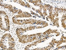 Invitrogen Phospho-NPM1 (Ser125) Polyclonal Antibody 100 &mu;L | Buy Online | Invitrogen&trade; | Fisher Scientific