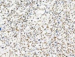 Invitrogen Phospho-NPM1 (Ser125) Polyclonal Antibody 100 &mu;L | Buy Online | Invitrogen&trade; | Fisher Scientific