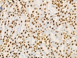 Invitrogen Phospho-NPM1 (Ser125) Polyclonal Antibody 100 &mu;L | Buy Online | Invitrogen&trade; | Fisher Scientific
