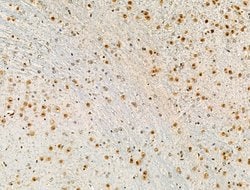 Invitrogen Phospho-NPM1 (Ser125) Polyclonal Antibody 100 &mu;L | Buy Online | Invitrogen&trade; | Fisher Scientific