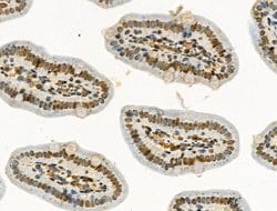 Invitrogen Phospho-NPM1 (Ser125) Polyclonal Antibody 100 &mu;L | Buy Online | Invitrogen&trade; | Fisher Scientific