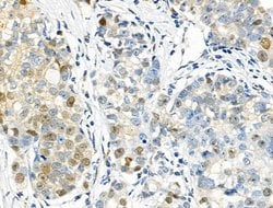 Invitrogen Phospho-p57 Kip2 (Thr310) Polyclonal Antibody 100 &mu;L | Buy Online | Invitrogen&trade; | Fisher Scientific