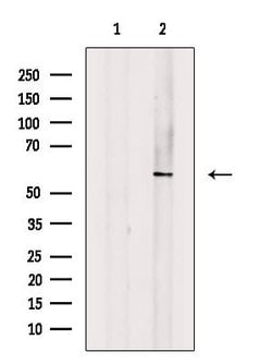 Invitrogen Phospho-p57 Kip2 (Thr310) Polyclonal Antibody 100 &mu;L | Buy Online | Invitrogen&trade; | Fisher Scientific