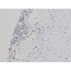 Invitrogen Phospho-p70 S6 Kinase (Thr252) Polyclonal Antibody 100 &mu;L;