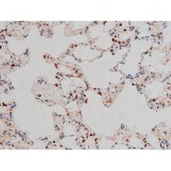 Invitrogen Phospho-p70 S6 Kinase (Thr252) Polyclonal Antibody 100 &mu;L;
