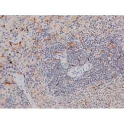 Invitrogen Phospho-p70 S6 Kinase (Thr252) Polyclonal Antibody 100 &mu;L;