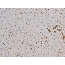 Invitrogen Phospho-p70 S6 Kinase (Thr252) Polyclonal Antibody 100 &mu;L;