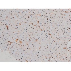 Invitrogen Phospho-p70 S6 Kinase (Thr252) Polyclonal Antibody 100 &mu;L;
