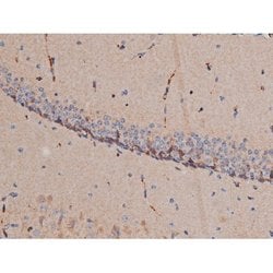 Invitrogen Phospho-p70 S6 Kinase (Thr252) Polyclonal Antibody 100 &mu;L;