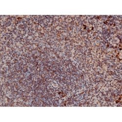Invitrogen Phospho-p70 S6 Kinase (Thr252) Polyclonal Antibody 100 &mu;L;
