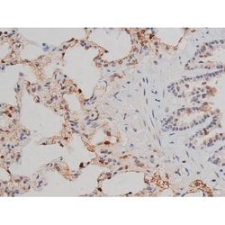 Invitrogen Phospho-p70 S6 Kinase (Thr252) Polyclonal Antibody 100 &mu;L;