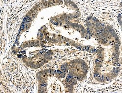 Invitrogen Phospho-PAK4/6/7 (Ser474) Polyclonal Antibody 100 &mu;L; Unconjugated:Antibodies,