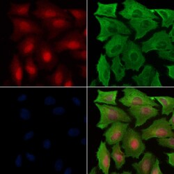 Invitrogen Phospho-Parkin (Ser65) Polyclonal Antibody 100 &mu;L; Unconjugated:Antibodies,