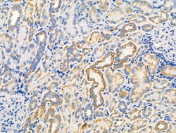 Invitrogen Phospho-Paxillin (Ser272) Polyclonal Antibody 100 &mu;L | Buy Online | Invitrogen&trade; | Fisher Scientific