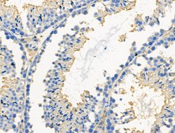 Invitrogen Phospho-Paxillin (Ser272) Polyclonal Antibody 100 &mu;L | Buy Online | Invitrogen&trade; | Fisher Scientific