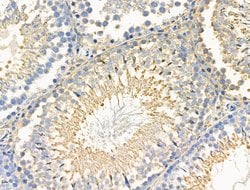 Invitrogen Phospho-Paxillin (Ser272) Polyclonal Antibody 100 &mu;L | Buy Online | Invitrogen&trade; | Fisher Scientific