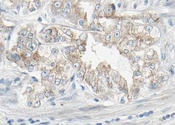 Invitrogen Phospho-PDGFRB (Tyr1021) Polyclonal Antibody 100 &mu;L | Buy Online | Invitrogen&trade; | Fisher Scientific