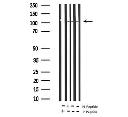 Invitrogen Phospho-PDGFRB (Tyr1021) Polyclonal Antibody 100 &mu;L | Buy Online | Invitrogen&trade; | Fisher Scientific