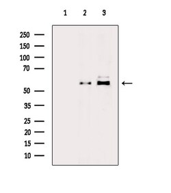 Invitrogen Phospho-PFKFB3 (Ser461) Polyclonal Antibody 100 &mu;L | Buy Online | Invitrogen&trade; | Fisher Scientific
