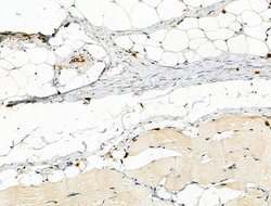 Invitrogen Phospho-PFKFB3 (Ser461) Polyclonal Antibody 100 &mu;L | Buy Online | Invitrogen&trade; | Fisher Scientific