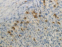 Invitrogen Phospho-PFKFB3 (Ser461) Polyclonal Antibody 100 &mu;L | Buy Online | Invitrogen&trade; | Fisher Scientific