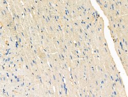 Invitrogen Phospho-PFKFB3 (Ser461) Polyclonal Antibody 100 &mu;L | Buy Online | Invitrogen&trade; | Fisher Scientific