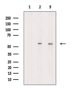 Invitrogen Phospho-PFKFB3 (Ser461) Polyclonal Antibody 100 &mu;L | Buy Online | Invitrogen&trade; | Fisher Scientific