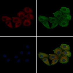 Invitrogen Phospho-Phospholamban (Ser16, Thr17) Polyclonal Antibody 100