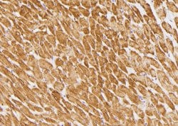 Invitrogen Phospho-Phospholamban (Ser16, Thr17) Polyclonal Antibody 100