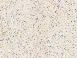 Phospho-Phospholamban (Ser714) Polyclonal Antibody:Antibodies, Polyclonal