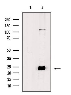 Phospho-Phospholamban (Ser714) Polyclonal Antibody:Antibodies, Polyclonal