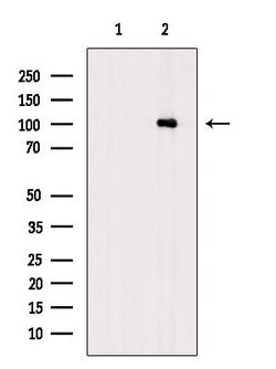 Phospho-PKC mu (Ser205) Polyclonal Antibody:Antibodies, Polyclonal