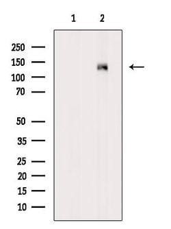 Phospho-PKC mu (Ser910) Polyclonal Antibody:Antibodies, Polyclonal