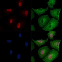 Invitrogen Phospho-PP1 alpha (Thr320) Polyclonal Antibody 100 &mu;L; Unconjugated:Antibodies,