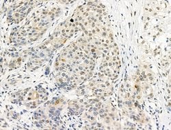 Invitrogen Phospho-PP1 alpha (Thr320) Polyclonal Antibody 100 &mu;L; Unconjugated:Antibodies,