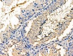 Invitrogen Phospho-PP1 alpha (Thr320) Polyclonal Antibody 100 &mu;L; Unconjugated:Antibodies,