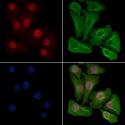Invitrogen Phospho-Progesterone Receptor (Ser190) Polyclonal Antibody 100